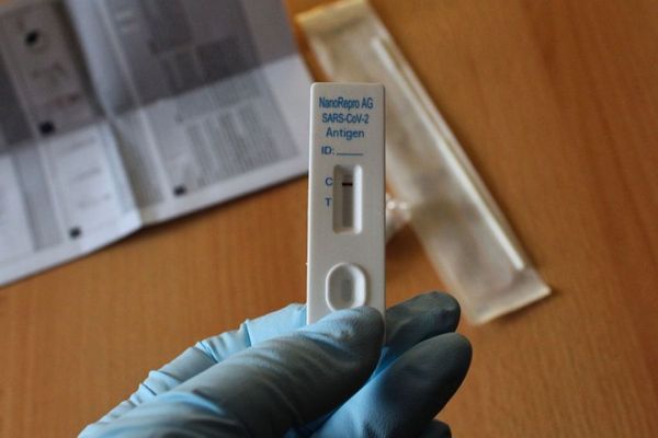 Toscana: Coronavirus, 1.514 nuovi casi, età media 53 anni. Nessun decesso
